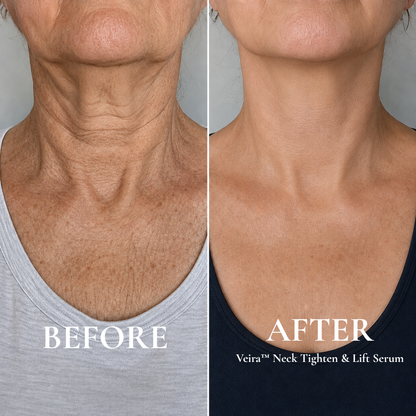 Veira™ Neck Tighten & Lift Serum